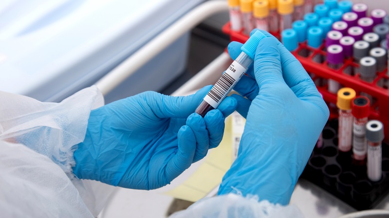 Bảng giá Xét nghiệm